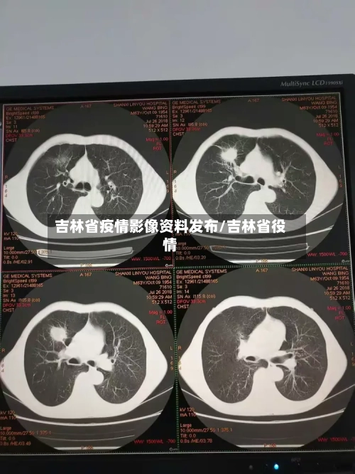 吉林省疫情影像资料发布/吉林省役情-第2张图片