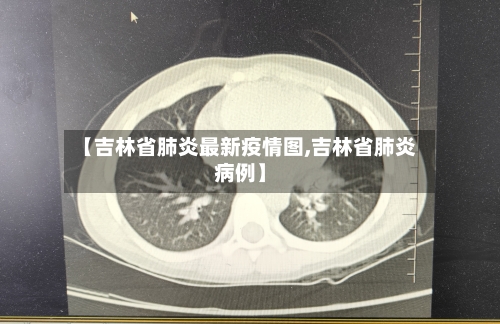 【吉林省肺炎最新疫情图,吉林省肺炎病例】-第2张图片