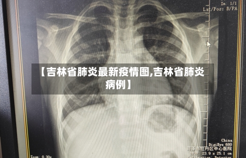【吉林省肺炎最新疫情图,吉林省肺炎病例】-第1张图片